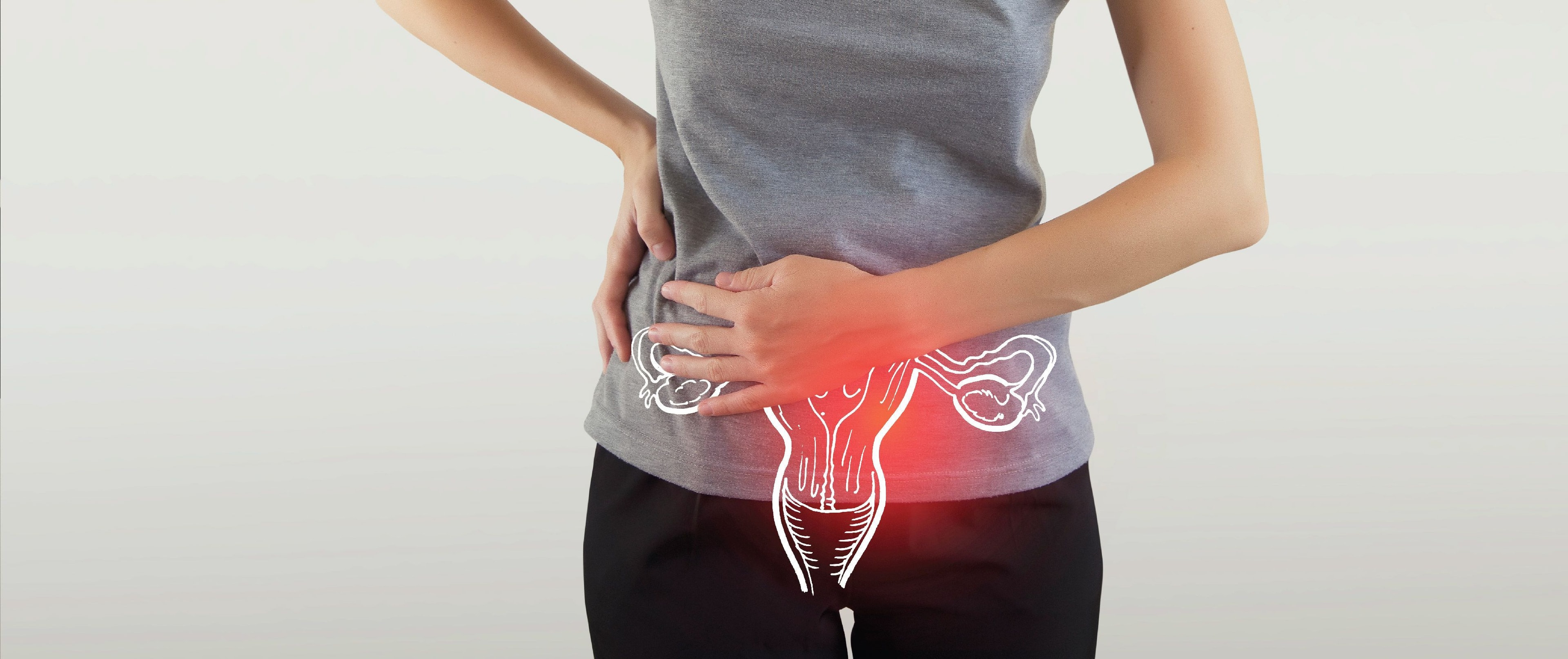 PCOS/PCOD Management